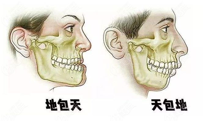 是何锦泉和<!--<i data=20240703-sp></i>-->做地包天手术的优势