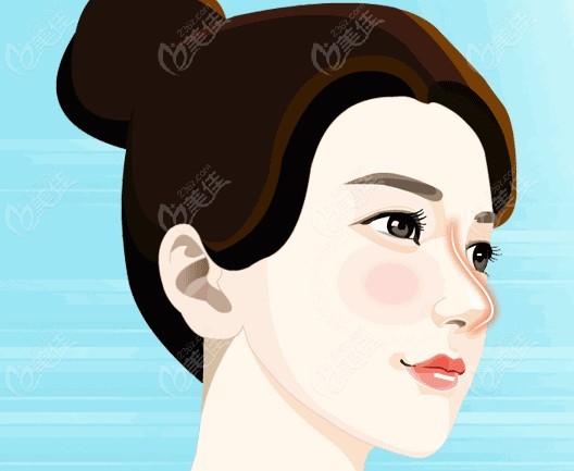 杭州谭晓燕医生做的半肋骨鼻子图片美佳网
