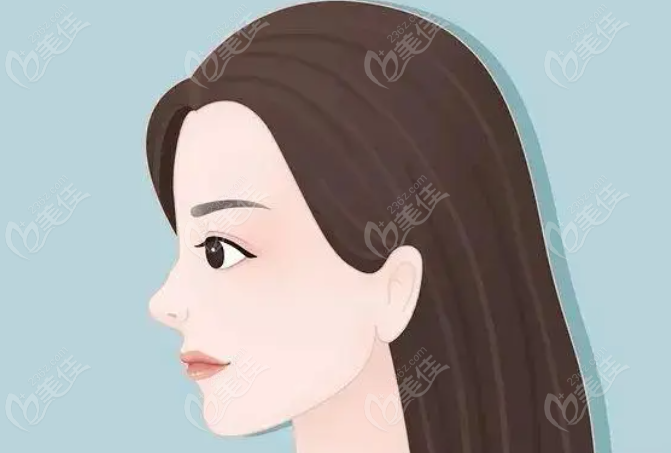 杭州谭晓燕医生做的全肋骨鼻图片