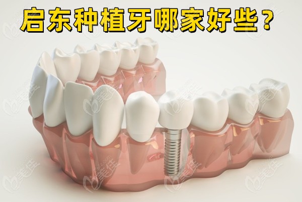 启东种植牙哪家好些？