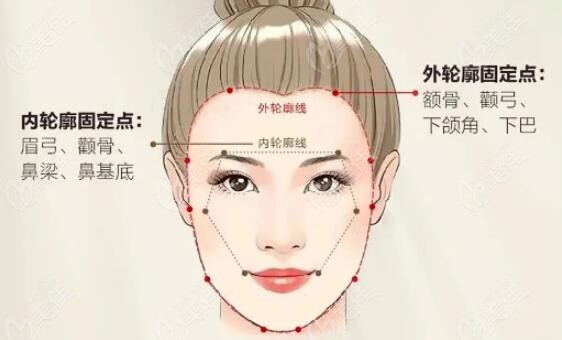 先固定外轮廓还是内轮廓