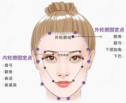 玻尿酸外輪廓固定236z.com