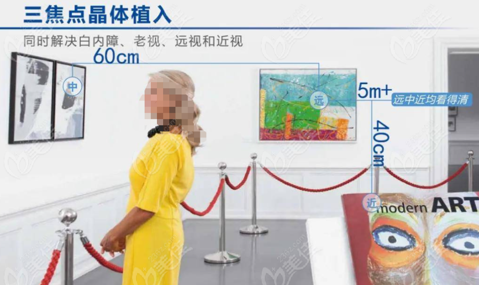 三焦點帶散光人工晶體優(yōu)缺點 三焦點帶散光人工晶體優(yōu)缺點