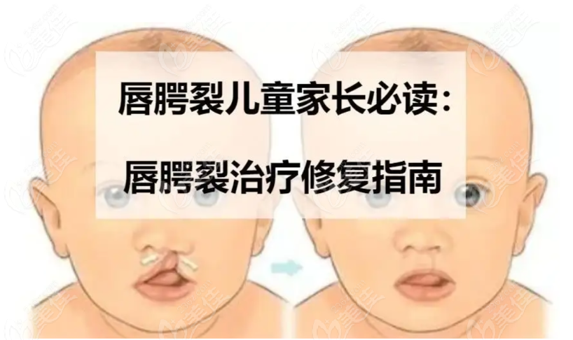 隱形唇裂修復好的醫(yī)院強烈推薦廣州高尚/上海時光