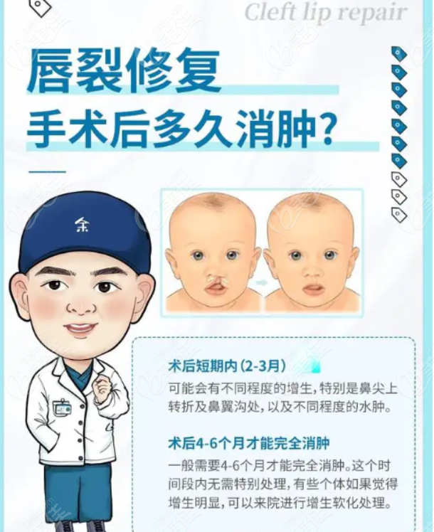 上海時光整形外科醫(yī)院唇裂修復怎么樣