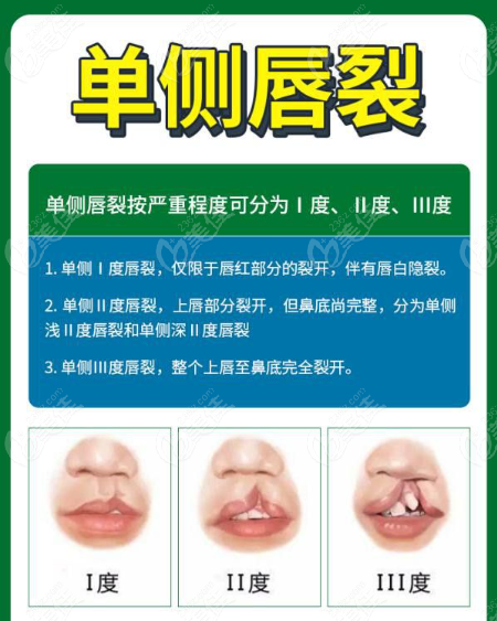 北京正美唇裂修復怎么樣