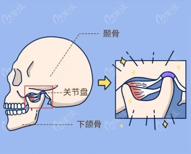 羅延平醫生的磨骨技術好