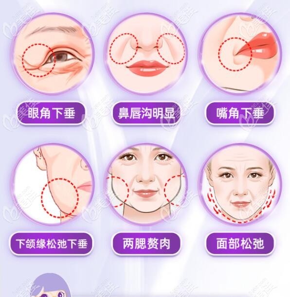 上海雙面網兜提升醫生排名前十名