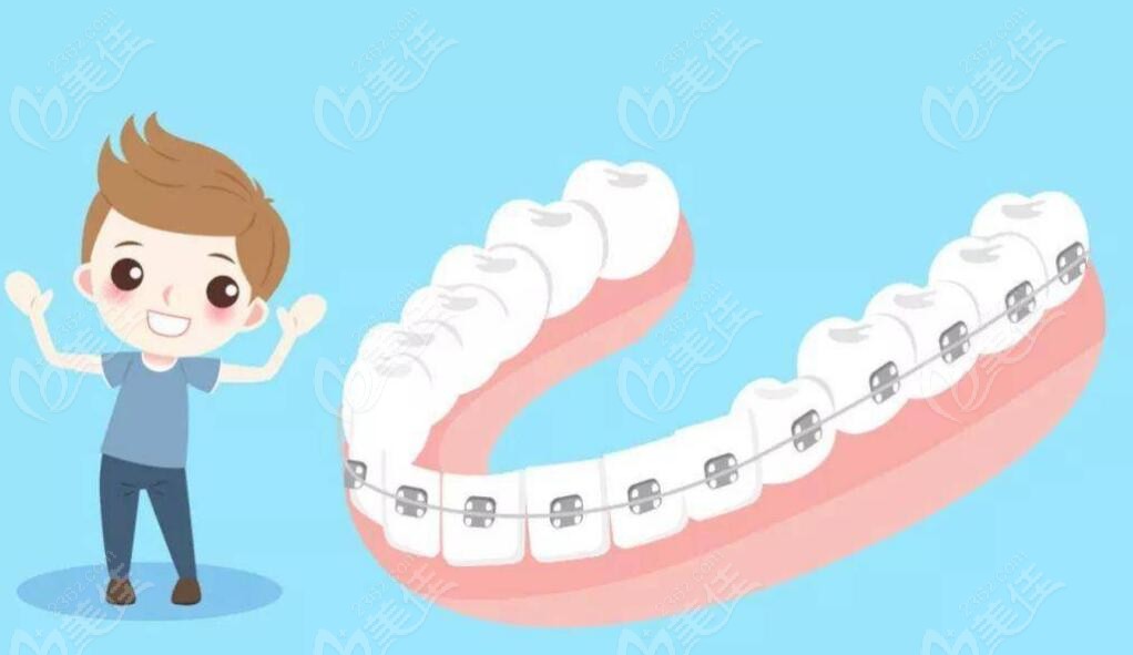 合肥贝尔口腔牙齿矫正价格多少钱?