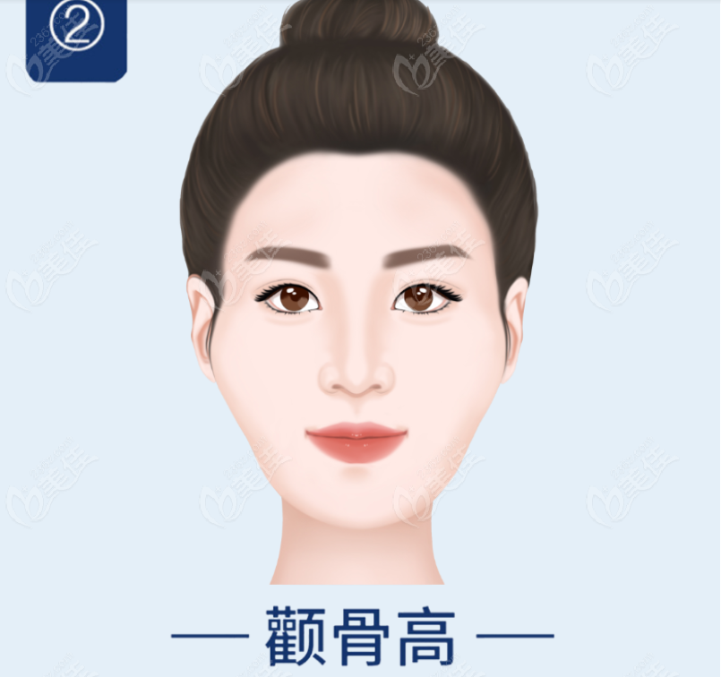何晉龍顴骨內推多少錢