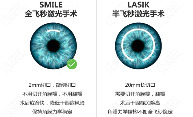 何氏眼科可以做全飞秒激光近视眼手术