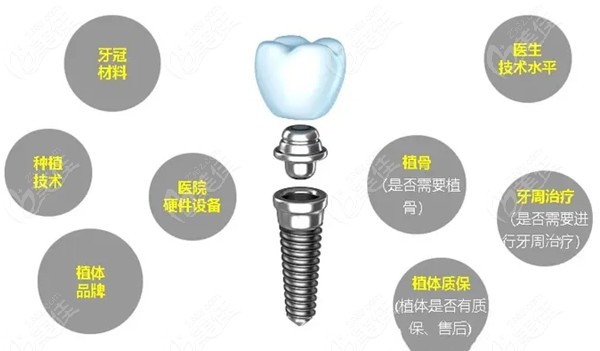 番禺區口腔醫院種牙價格包含：麻醉|手術|種植牙材料費