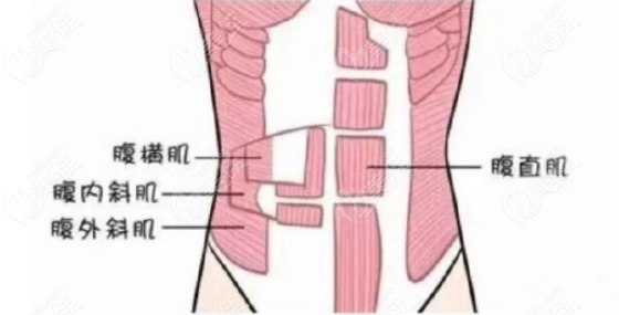 腹直肌分離3指需要修復嗎m.236z.com