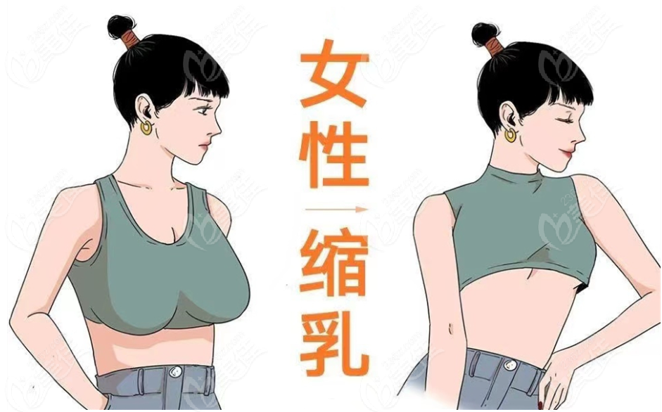 <!--<i data=20240703-sp></i>-->乳房缩小整容医院排名top10榜单