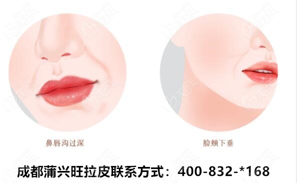 成都蒲興旺拉皮聯系方式