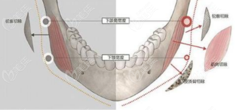 怎么拥有清晰的下颌角 20231215_1702632115924543.png