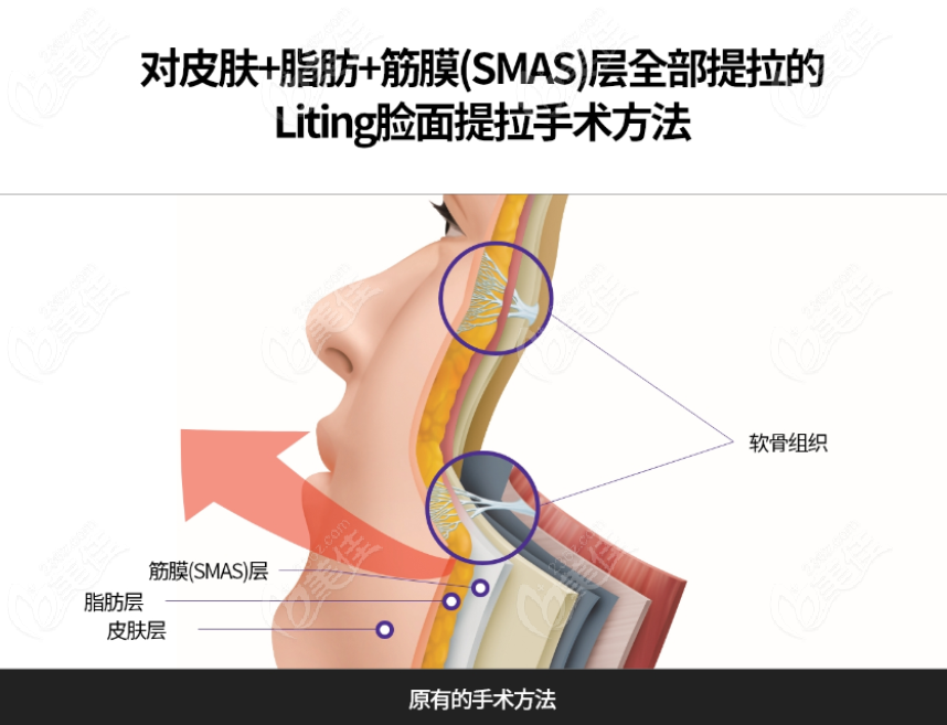<!--<i data=20240703-sp></i>-->倪锋医生做拉皮怎么样