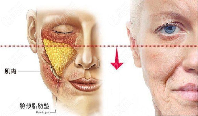 蒲兴旺拉皮做的怎么样？