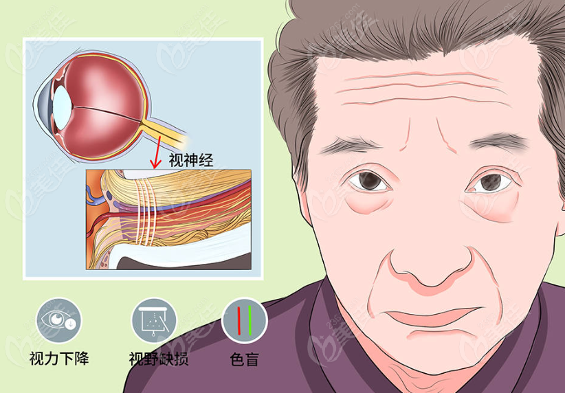 吉林恒達眼科醫院視網膜色素變性手術價格