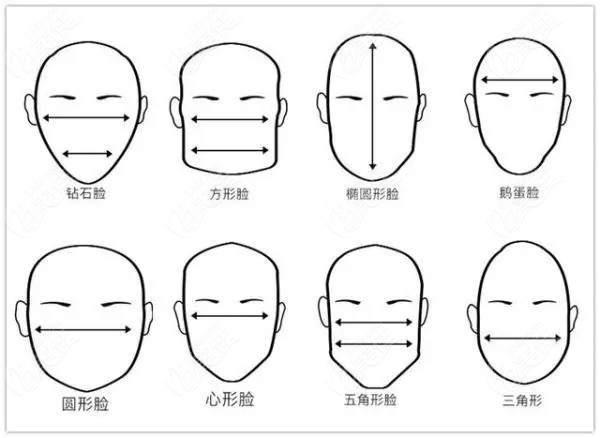 幼态脸打造是做填充还是提拉改善是看脸型的