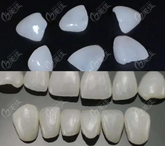 大连做牙贴面价格表m.236z.com