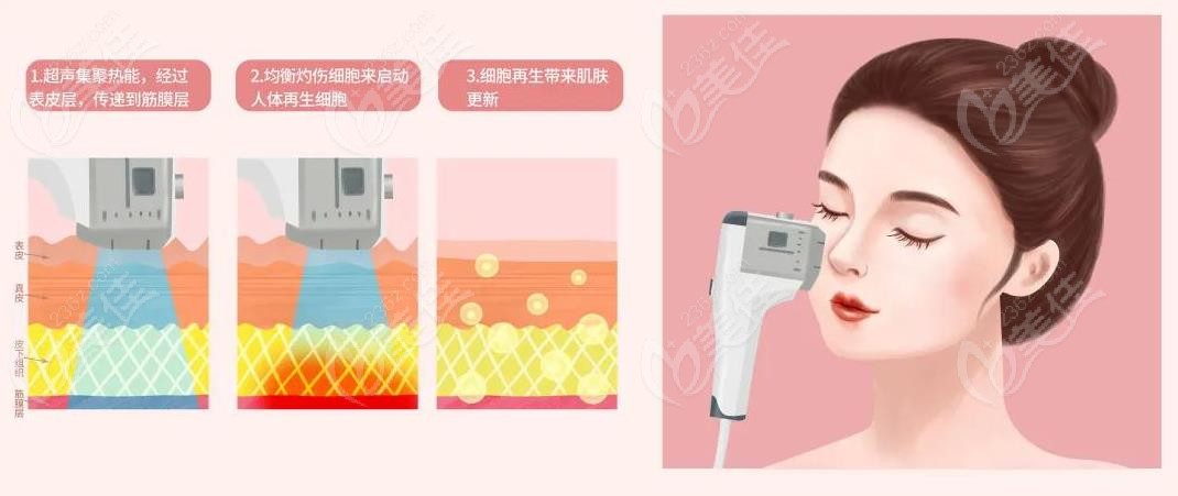 合肥超声炮多少钱一次