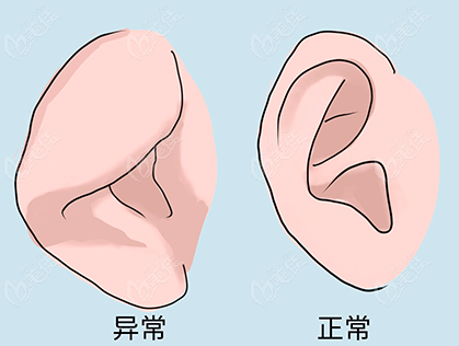 国内正规耳朵整形手术医院排名