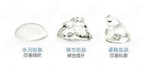 南昌韓美整形會根據顧客的面部選擇適合的玻尿酸