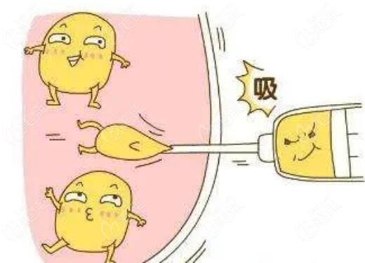 沈阳元辰医美谭院长做吸脂好