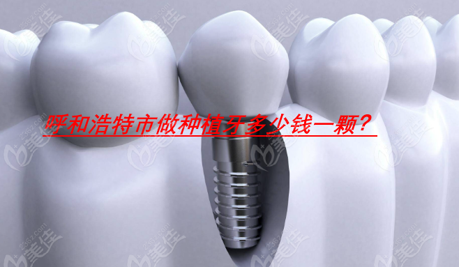 呼和浩特市种植牙一颗多少钱？www.236z.com