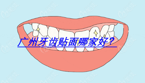 广州牙齿贴面医院排名