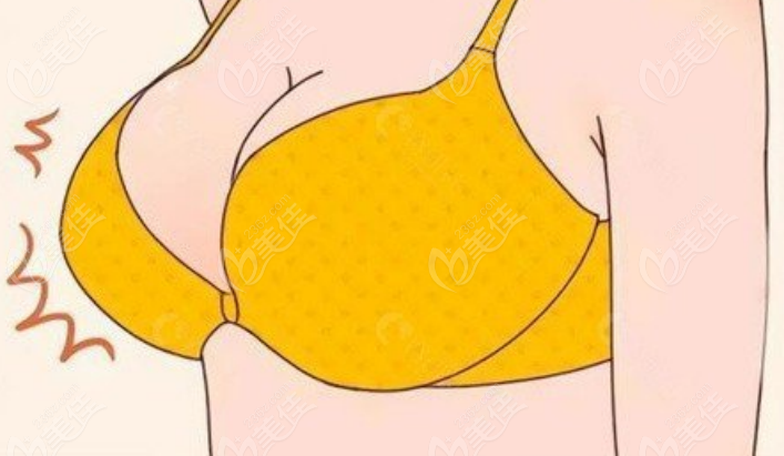 假體隆胸236z.com