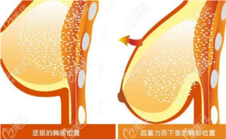 236z.com縮胸手術(shù) 236z.com縮胸手術(shù)