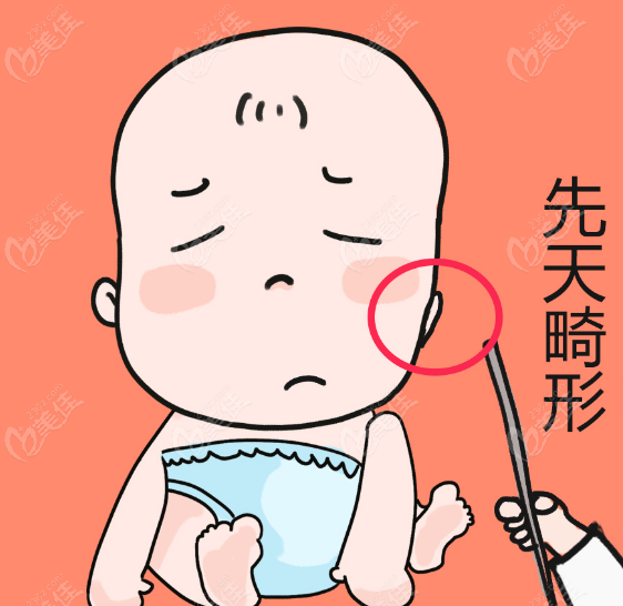 耳再造是余文林親自手術(shù)嗎www.23/6z.com
