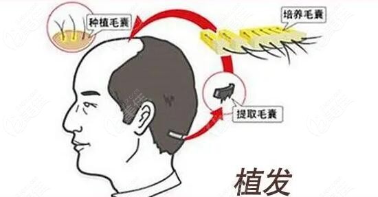 重庆时光植发医院怎么样