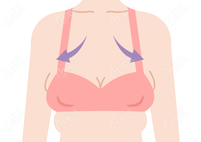栗勇做縮胸手術(shù)多少錢www.236z.com