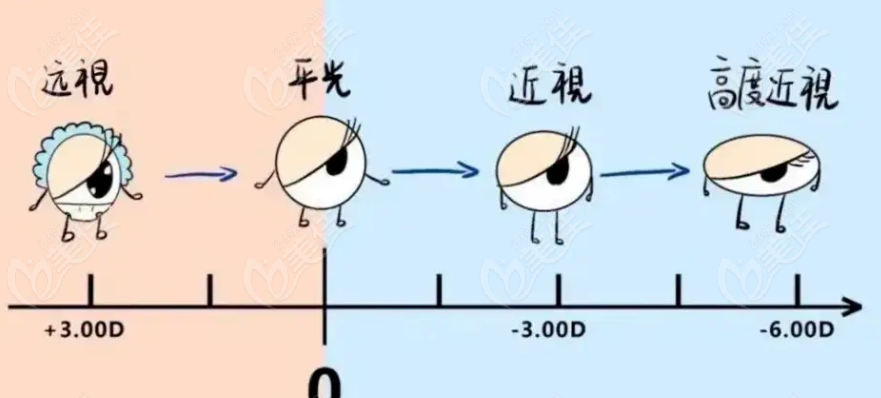 褚仁遠的后鞏膜加固術費用