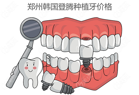郑州韩国登腾种植牙价格www.236z.com
