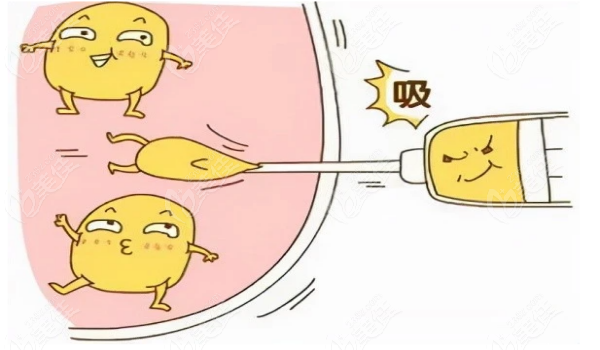 北京煤医周云超怎么挂号