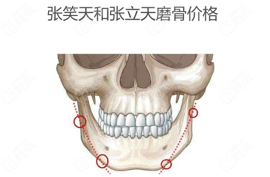 張笑天和張立天磨骨價格