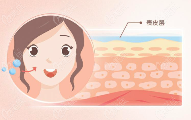 玻尿酸填充面部需要经常填充吗