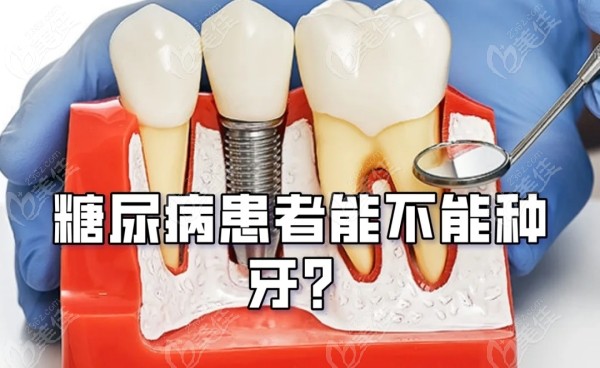 糖尿病人牙齿掉了可以镶牙吗