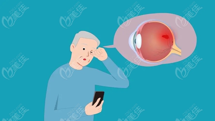 糖尿病做白內障手術多久恢復