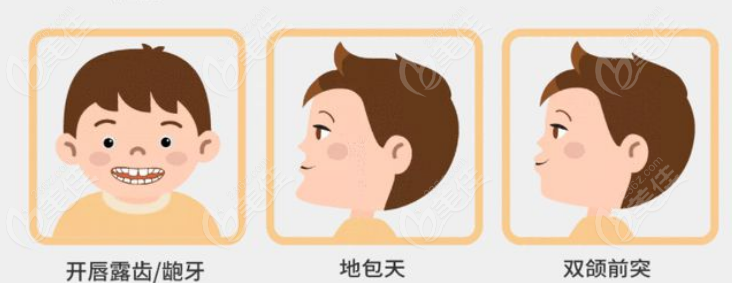 刘若曦正畸好