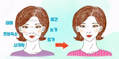 正规韩国皮肤科价格表