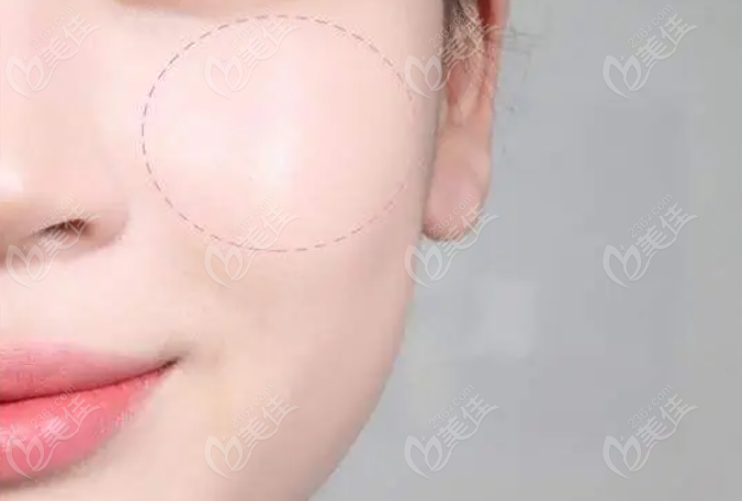 怎么样减少脂肪 20240227_1708999174940363.png