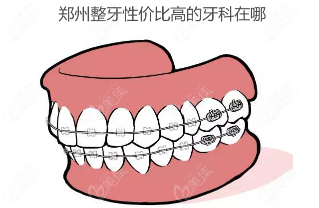 郑州整牙性价比高的牙科在哪www.236z.com