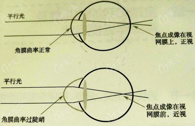 眼科k1k2正常值