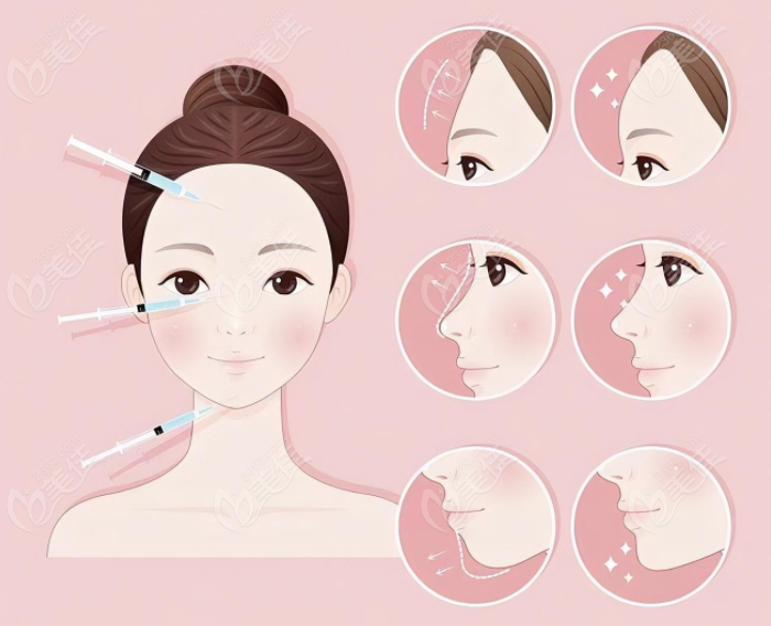 北京王阔远治疗馒化脸怎么样www.236z.com