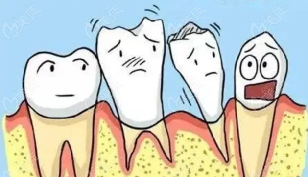 牙周炎导致牙龈萎缩